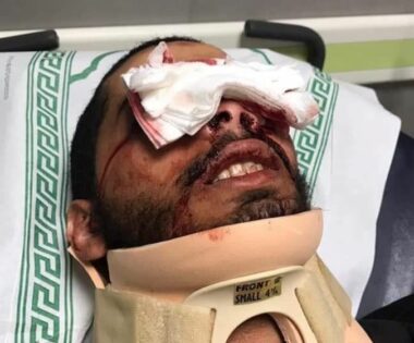 Nazi Soldiers Injure 205 Palestinians In Jerusalem