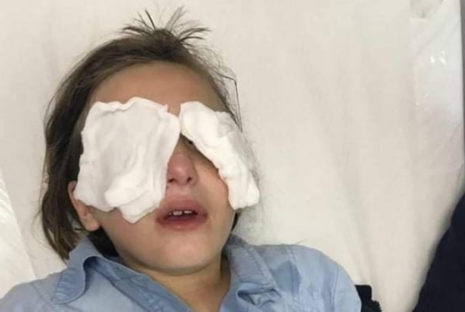 Palestine: Nazi Jewish Settler Pepper-Sprays Four Girls in Sheikh Jarrah