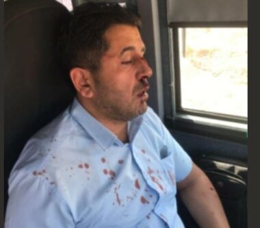 Jerusalem: Nazi Jewish Colonizer Attacks Palestinian Bus Driver