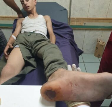Nazi Jewish Colonizers Assault A Palestinian Child In Jenin After Abducting Him