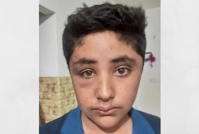 Ramallh: Nazi Soldiers Beat up, Detain 13-Year-Old Palestinian
