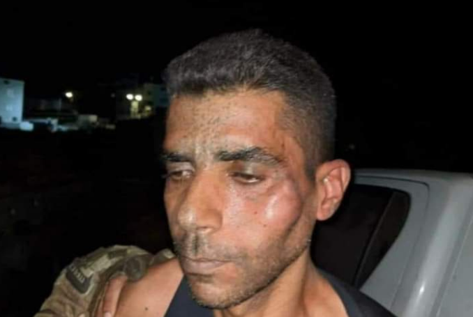 Prisoners’ Lawyer: Zakaria Zubeidi was Severely Beaten after Arrest, Suffers from Broken Jaws, Ribs