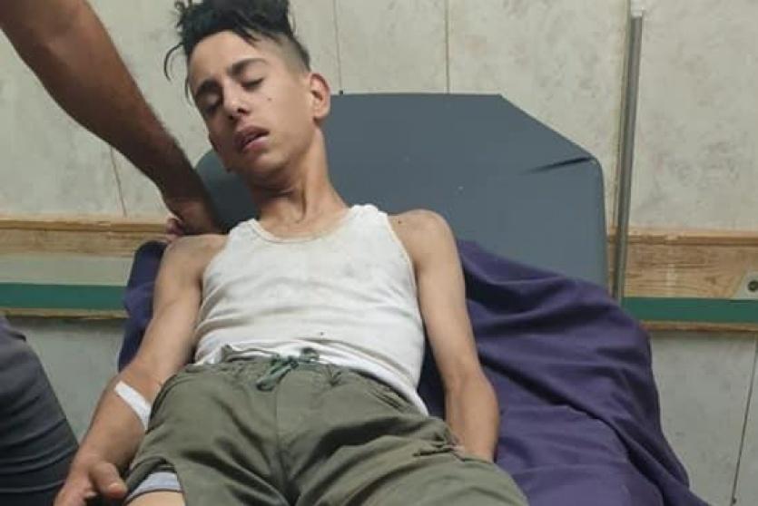 Palestinian Teen Kidnapped, Tortured in Nazi Settler Attack