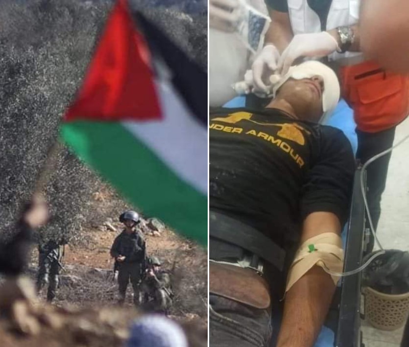 Nazi Army Injures Dozens of Palestinians in Beita and Beit Dajan Protests
