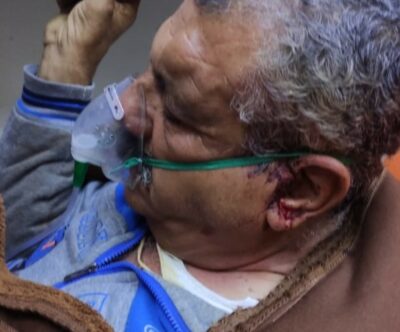 Nablus: Nazi Colonizers Injure Many Palestinians In Qaryout