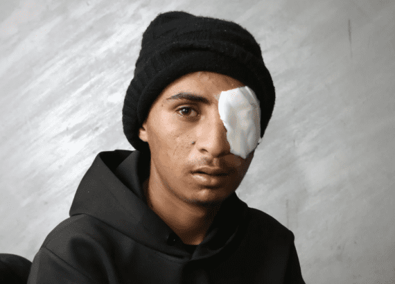Ten Days, Five Nazi Bullets, Five Bedouin With Serious Head Injuries