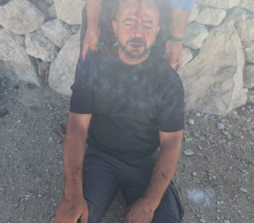 Ramallah: Nazi Jewish Colonizers Assault a Palestinian Man Near Hebron, Burn Lands